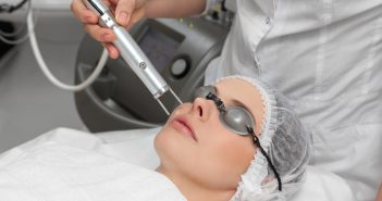 Mélasma : une nouvelle voie thérapeutique vasculaire ?