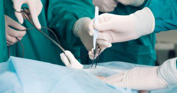 Hyménoplastie : quelles sont les techniques chirurgicales possibles ?