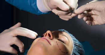 Lifting cervico-facial sous anesthésie locale : pourquoi et comment ?