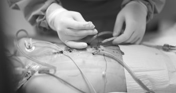Le lambeau perforant mammaire interne (IMAP) : technique opératoire et indications en chirurgie cervicofaciale
