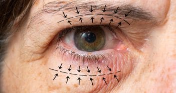 Champ visuel automatisé et prise en charge des blépharoplasties supérieures