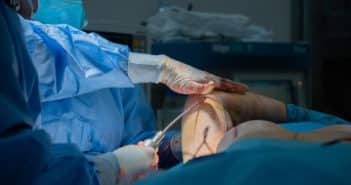 La lipoaspiration et les techniques assistées